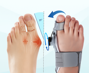 Corrector De Juanetes Ajustable